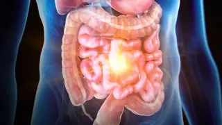 Colon Chip uncovers fibroblasts as key drivers of IBD and early cancer signals