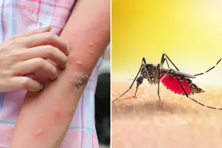 Florida fights rising locally acquired dengue as mosquito control tightens
