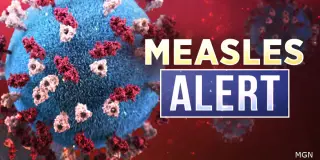 Delta County Reports First Measles Cases in Upper Peninsula Since 1989