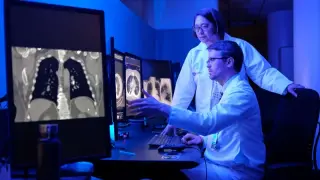Beyond smoking: debunking lung cancer myths and the case for broader screening