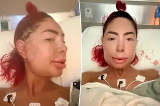 Farrah Abraham’s Jaw Surgery Leaves Her Unable to Speak and in Severe Pain