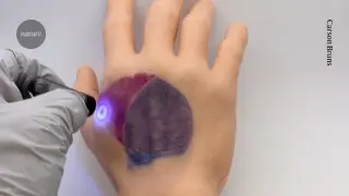 Light-Activated Ink Offers Reversible Tattoos for Medical and Cosmetic Use