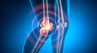 Scar-Driven Fibrosis Emerges as Target for Treatment-Resistant Rheumatoid Arthritis