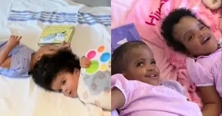 St. Louis separates Ethiopian craniopagus twins after 25-hour surgery