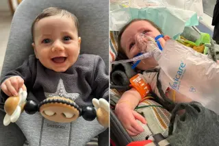 Baby’s Rare Neurological Disorder Triggers 12 Seizures in 48 Hours