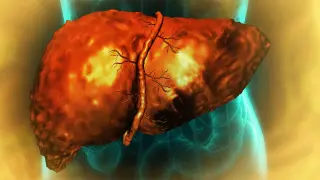 Alcohol inflammation traps liver cells in a regeneration limbo, study finds