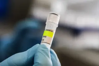 Why the hantavirus quarantine lasts six weeks