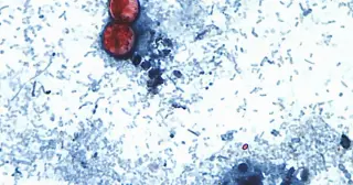 First 2026 cyclosporiasis case reported in Washoe County
