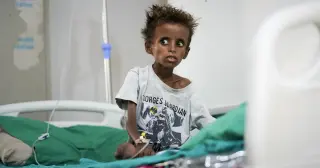 Yemen’s Health System Collapses as Houthi Advance Triggers Mass Displacement and Malnutrition