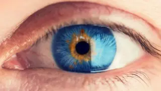 Optogenetic Therapy Restores Partial Vision in 10 Blind Patients