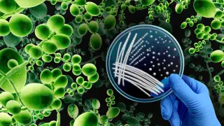 Drug-resistant Candida auris spreads across the U.S.; California leads infections