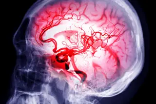 Circadian Clock Therapies Boost Stroke Recovery by Enhancing Brain Waste Clearance in Mice