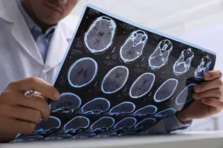 Metamaterial MRI Antenna Delivers Sharper Eye and Brain Imaging on Existing Scanners