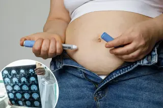 GLP-1 Weight-Loss Drugs May Accelerate ALS Progress, Doctors Warn