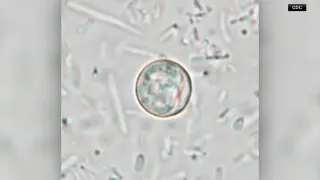 Houston-area cyclosporiasis cases rise as county tally hits 54