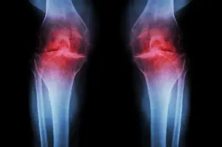 Low-Intensity Ultrasound Reprograms Immune Cells to Halt Joint Inflammation