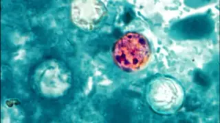 North State roundup: hostage released, fires contained, and Cyclospora alert
