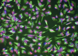Bonn Researchers Rejuvenate 80-Year-Old Blood Cells to Youthful Brain State