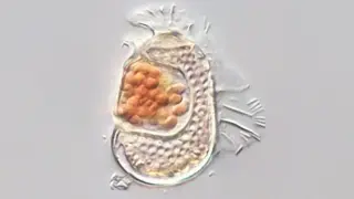 New Archaeon with 189 Genes Challenges Biological Definitions of Life