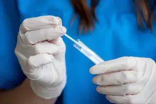 Spit test could slash years-long endometriosis diagnosis wait