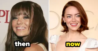 Then and Now: Celebrities' Transformations After Fame