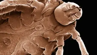 From Dog Ticks to Human Vaccines: A Growing Push to Prevent Lyme Disease