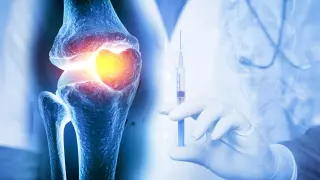 Regenerative Joint Therapies Reversing Osteoarthritis in Weeks, Aiming for Human Trials