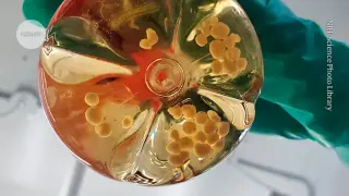 Consent urgently needed as brain-organoid biocomputing advances