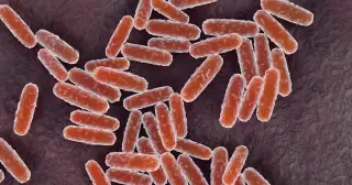 Russia Denies Plague Lab Accident as US Monitors Siberian Death