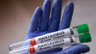 Hantavirus vaccines edge closer, but rollout remains years away