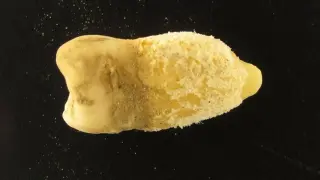 Ancient Bolivian Tooth Rewrites Scarlet Fever Timeline