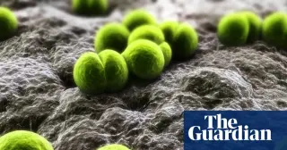 Berkshire meningitis outbreak: student dies, two more cases emerge as health chiefs respond