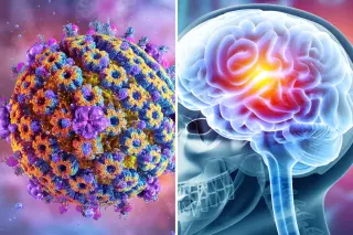 Cold Sore Virus Rewires Brain Immune Cells, Potentially Linking to Alzheimer's