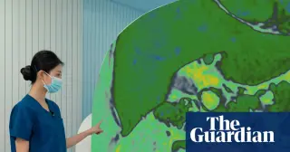 Screening Paradox: Why More Tests Don’t Always Improve Your Health