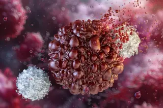 Stemming Pancreatic Cancer Before It Starts with KRAS Inhibitors