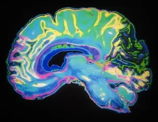 Orexin Neurons Drive Sustained Motivation, Rat Study Finds