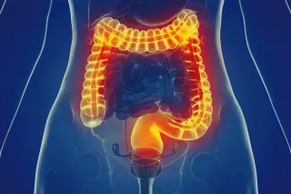 Blocking a Second Signal Reveals New Path to Calm Gut Inflammation