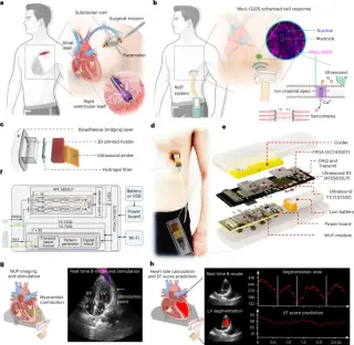 Wearable ultrasound pacemaker uses engineered channels to noninvasively pace the heart