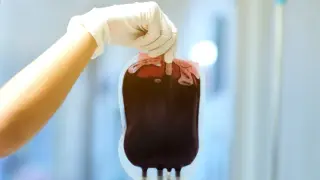 Could Alzheimer’s Pathology Be Transmitted Through Blood Transfusions?