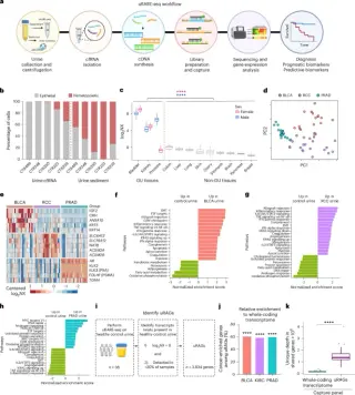 New Urine RNA Test Detects 95% of Bladder Cancers and Predicts Treatment Response