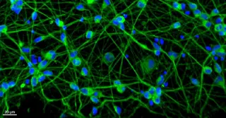 Scientists Aim to Clean Up RNA Pollution to Halt Neurodegeneration