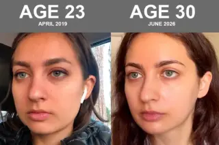 Biohacking girlfriend claims skin age is 21 at 30 after science-led regimen