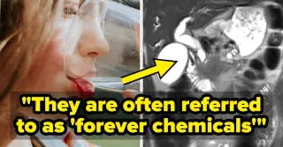 Experts Weigh In on Viral Claims Linking Canned Sparkling Water to Colorectal Cancer