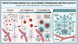 Protective Brain Microglia Rise with Alzheimer's Progression, Study Finds