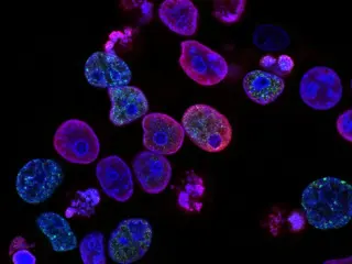 First Human Trial Tests Rejuvenation of Aging Eye Cells for Glaucoma