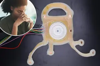 Sleep patch boosts REM sleep to curb daytime stress, study finds