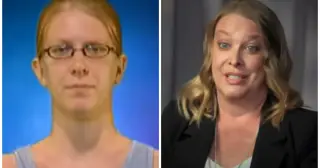 Former 'The Swan' Contestants Detail Long-Term Dental and Surgical Trauma in New Hulu Documentary