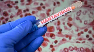 Hantavirus Outbreak Triggers Cautious Biotech Stock Rally