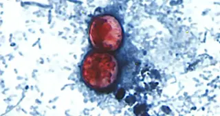 Cyclosporiasis outbreaks widen as sources beyond lettuce are suspected