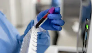 Rethinking PSA screening: when to discuss prostate cancer testing